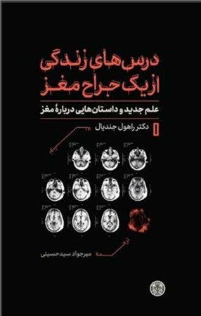 نمایش جزئیات برای  درس های زندگی از 1 جراح مغز (علم جدید و داستان هایی درباره مغز) تصویر  درس های زندگی از 1 جراح مغز (علم جدید و داستان هایی درباره مغز)